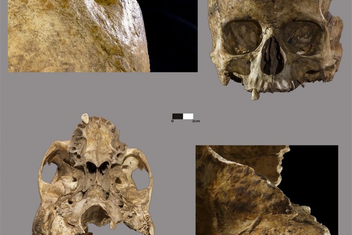 Lesiones y marcas de corte en el cráneo femenino de La Dehesilla. National Geographic, García-Rivero et al.