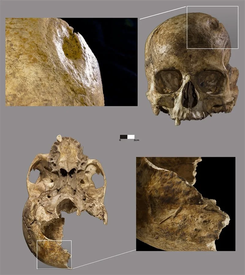 Lesiones y marcas de corte en el cráneo femenino de La Dehesilla. National Geographic, García-Rivero et al.
